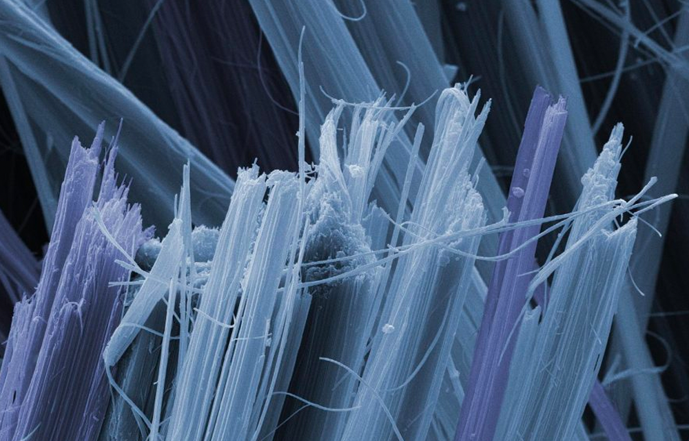 Photo of microscopic asbestos fibers. Asbestos testing is one of our inspection services.